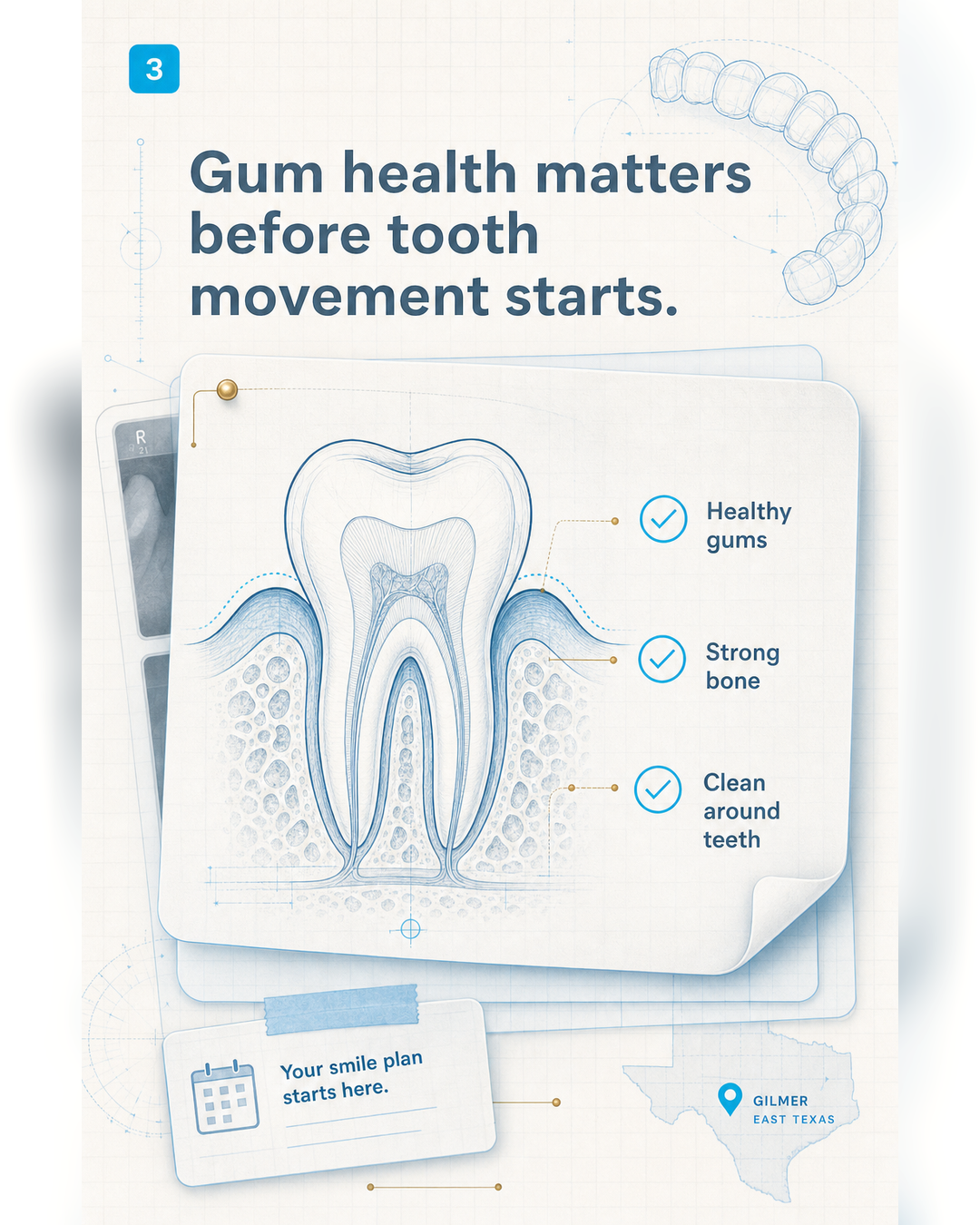Visual guide: how to think about Invisalign candidacy before a consultation - slide 3 - Gum health matters before tooth movement starts.