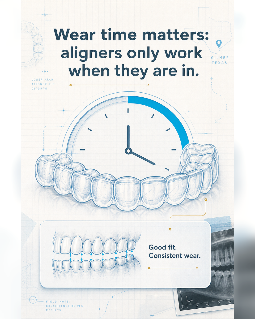 Visual guide: how to think about Invisalign candidacy before a consultation - slide 5 - Wear time matters: aligners only work when they are in.